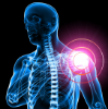 Picture of VR THERAPY CENTER SHOULDER PAIN
