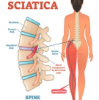 Picture of VR THERAPY CENTER SCIATICA