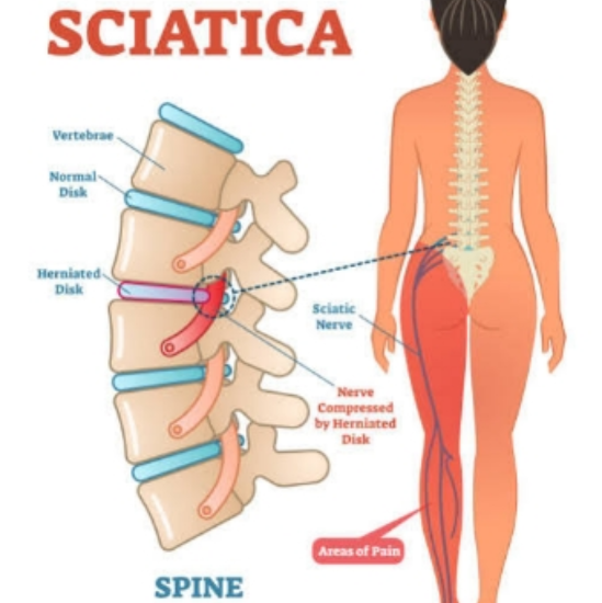 Picture of VR THERAPY CENTER SCIATICA