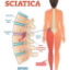 Picture of VR THERAPY CENTER SCIATICA